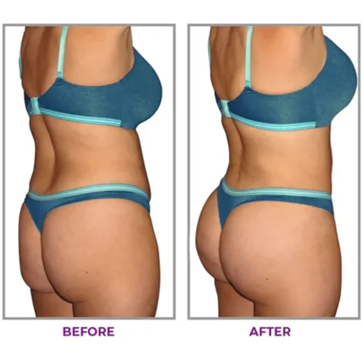 KISSHI™ Hip Plump Capric Oil