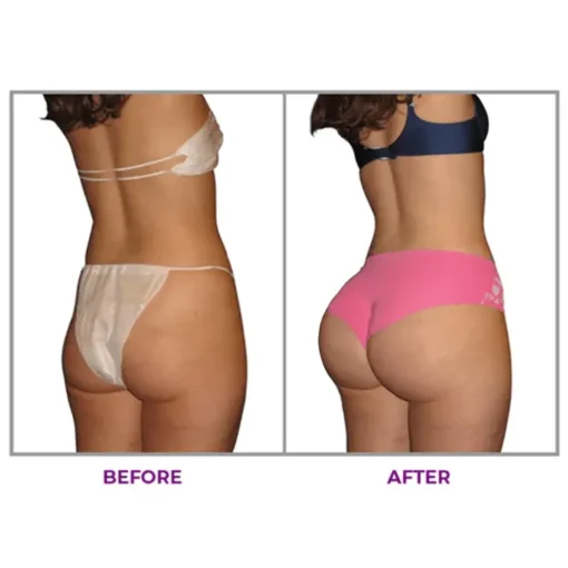 KISSHI™ Hip Plump Capric Oil
